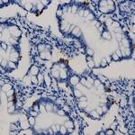 SCG2 (Secretogranin II) Antibody in Immunohistochemistry (Paraffin) (IHC (P))