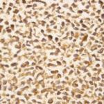 STK17b Antibody in Immunocytochemistry (ICC/IF)