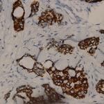 Phospho-Raf-A (Ser186) Antibody in Immunohistochemistry (Paraffin) (IHC (P))