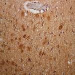 Phospho-Parkin (Ser56) Antibody in Immunohistochemistry (Paraffin) (IHC (P))