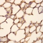 NAPRT Antibody in Immunohistochemistry (Paraffin) (IHC (P))