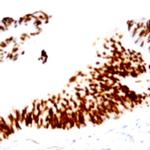 Nucleophosmin (NPM) Antibody in Immunohistochemistry (Paraffin) (IHC (P))