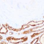 Neuropilin-1 Antibody in Immunohistochemistry (Paraffin) (IHC (P))
