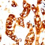 Neuropilin-2 Antibody in Immunohistochemistry (Paraffin) (IHC (P))