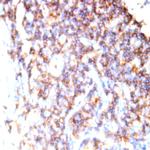 CD44 Antibody in Immunohistochemistry (Paraffin) (IHC (P))