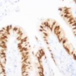 SirT1 Antibody in Immunohistochemistry (Paraffin) (IHC (P))