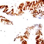 SNAI-2 Antibody in Immunohistochemistry (Paraffin) (IHC (P))