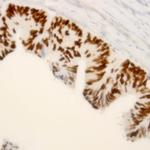 ZEB1 Antibody in Immunohistochemistry (Paraffin) (IHC (P))
