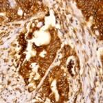 ALK/p80 Antibody in Immunohistochemistry (Paraffin) (IHC (P))