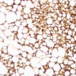 MLH1 Antibody in Immunohistochemistry (Paraffin) (IHC (P))