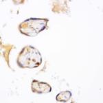 MSH2 Antibody in Immunohistochemistry (Paraffin) (IHC (P))