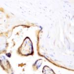MSH6 Antibody in Immunohistochemistry (Paraffin) (IHC (P))