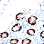 PMS2 Antibody in Immunohistochemistry (Paraffin) (IHC (P))