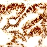 PD-1 Antibody in Immunohistochemistry (Paraffin) (IHC (P))
