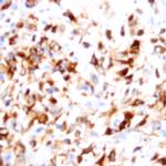 CD81 Antibody in Immunohistochemistry (Paraffin) (IHC (P))