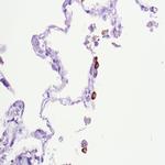 SARS-CoV2 (S1) Antibody in Immunohistochemistry (Paraffin) (IHC (P))