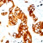 Phospho-AXL/UFO (Tyr812) Antibody in Immunohistochemistry (Paraffin) (IHC (P))