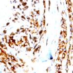 Phospho-AXL/UFO (Tyr770) Antibody in Immunohistochemistry (Paraffin) (IHC (P))