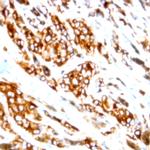 Phospho-AXL/UFO (Tyr857) Antibody in Immunohistochemistry (Paraffin) (IHC (P))