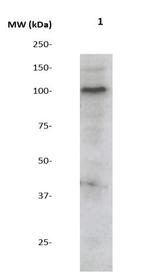 Phospho-AXL/UFO (Tyr857) Antibody in Western Blot (WB)