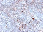 SATB1 (Marker of Lymph Node Metastasis of CRC) Monoclonal Antibody (SATB1/2661)