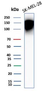 CEACAM1 (CEA Cell Adhesion Molecule 1) Antibody in Western Blot (WB)