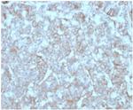Monocyte Chemotactic Protein 2 (MCP2)/CCL8 Monoclonal Antibody (CCL8/3312)