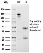 Monocyte Chemotactic Protein 2 (MCP2)/CCL8 Antibody in Immunoelectrophoresis (IE)