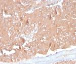 Monocyte Chemotactic Protein 2 (MCP2)/CCL8 Monoclonal Antibody (CCL8/3686)