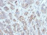 CCL18/C-C motif chemokine ligand 18 Antibody in Immunohistochemistry (Paraffin) (IHC (P))