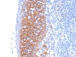 CD138/Syndecan-1 (SDC1) (Plasma Cell Marker) Antibody in Immunohistochemistry (Paraffin) (IHC (P))