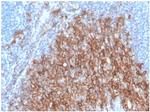 CD138/Syndecan-1 (SDC1) (Plasma Cell Marker) Recombinant Rabbit Monoclonal Antibody (SDC1/4378R)