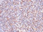 SDHB (Succinate Dehydrogenase B) (Pheochromocytoma Marker) Antibody in Immunohistochemistry (Paraffin) (IHC (P))
