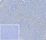 CD62E/Selectin E (SELE)/ELAM-1 Recombinant Mouse Monoclonal Antibody (r16G4)