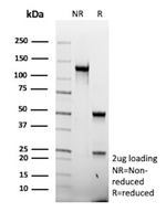 CD62E/Selectin E (SELE)/ELAM-1 Antibody in SDS-PAGE (SDS-PAGE)