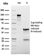 CD62L (L-Selectin) Monoclonal Antibody (LAM1-116)