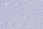 CD162 (Selectin P Ligand) Recombinant Rabbit Monoclonal Antibody (PSGL1/8192R)