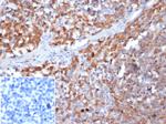 Gamma-parvin Antibody in Immunohistochemistry (Paraffin) (IHC (P))