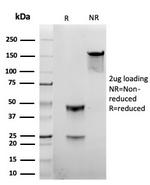 Gamma-parvin Antibody in SDS-PAGE (SDS-PAGE)