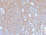 Gamma-parvin (PARVG) Recombinant Rabbit Monoclonal Antibody (PARVG, 6312R)
