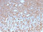 Gamma-parvin (PARVG) Antibody in Immunohistochemistry (Paraffin) (IHC (P))