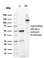 Gamma-parvin (PARVG) Antibody in SDS-PAGE (SDS-PAGE)