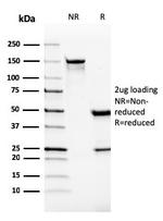 VISTA/GI24 (Negative Regulator of Immune Response) Antibody in SDS-PAGE (SDS-PAGE)