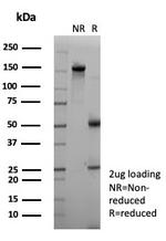 NECAB1/EF-hand calcium binding protein 1 Antibody in SDS-PAGE (SDS-PAGE)
