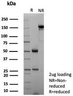 NECAB1/EF-hand calcium binding protein 1 Antibody in SDS-PAGE (SDS-PAGE)