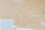 CXCR5 (Marker of T Follicular Helper (Tfh) Cells) Antibody in Immunohistochemistry (Paraffin) (IHC (P))