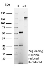 CXCR5 (Marker of T Follicular Helper (Tfh) Cells) Antibody in SDS-PAGE (SDS-PAGE)