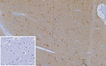 CXCR5 (Marker of T Follicular Helper (Tfh) Cells) Antibody in Immunohistochemistry (Paraffin) (IHC (P))
