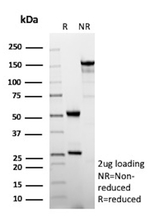 CXCR5 (Marker of T Follicular Helper (Tfh) Cells) Antibody in SDS-PAGE (SDS-PAGE)