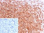 CXCR5/CXCL13/CD185 Recombinant Rabbit Monoclonal Antibody (CXCR5/8146R)